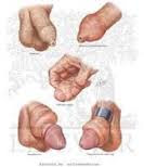 Illustration for article titled Apa Obat Gatal Dan
Bengkak Pada Kulup Penis Di Apotik Resep Dokter?